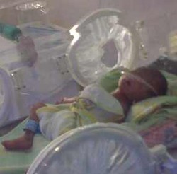 Dua Bayi Meninggal Sempat Alami Sesak Nafas Berat