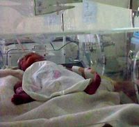 2 Dari Bayi Kembar 4 Meninggal