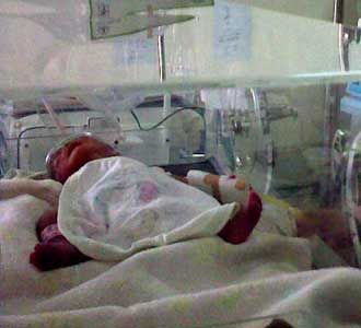 2 Dari Bayi Kembar 4 Meninggal