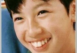 Gigi Kelinci dan Penyebabnya