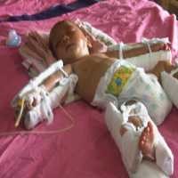 Yani Diduga Depresi, Polisi akan Datangkan Psikiater