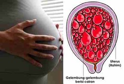 Hamil Anggur Bisa Dihindari dengan Konsumsi Vitamin A