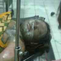 Kompor Ngebros, Pasutri di Ponorogo Terbakar