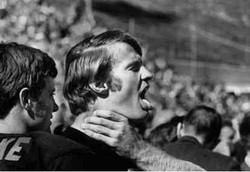 Sindrom Tangan Alien yang Merisaukan