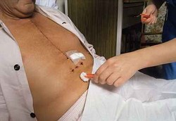 Cara Cepat Sembuh dari Sakit