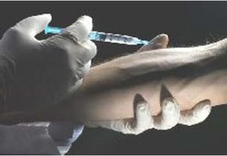 Kontrasepsi Hormonal, Pilihan KB Baru Untuk Pria