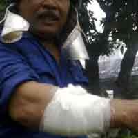 Petugas PMK Jadi Korban Saat Jinakkan Api