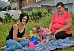 Si Kembar Siam Luar Biasa yang Bertahan dengan Satu Otak