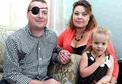 Suami Istri Sama-sama Terkena Kanker Langka