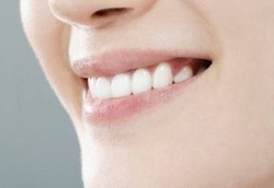 Gigi Bersih Bisa Mencegah Penuaan Dini