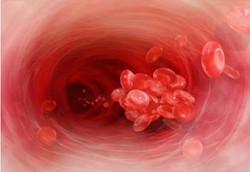 Darah Membeku yang Mengancam Jiwa