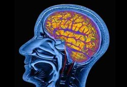 Scan Otak yang Bisa Baca Pikiran Tersembunyi