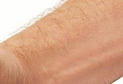 Kenapa Orang Bisa Merasa Merinding?