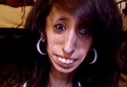 Sudah Makan 60 Kali Sehari, Tubuh Lizzie Tak Bisa Serap Lemak 