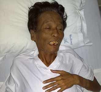 Pelawak Cholik Terbaring Lemah