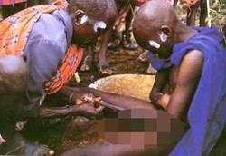 Sunat Pakai Tombak yang Bikin Nyawa Melayang