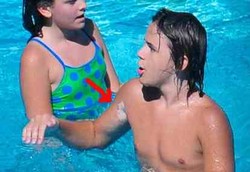 Penyakit Kulit Michael Jackson Menurun ke Anaknya