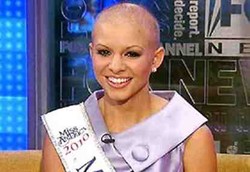 Kontestan Putri Cantik yang Menderita Kebotakan