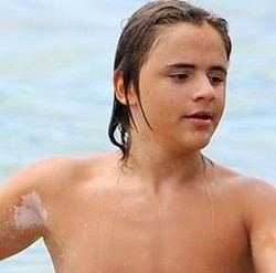 Anak Michael Jackson Diduga Menderita Kelainan Kulit 