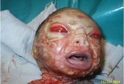 5 Penyakit yang Benar-benar Gila