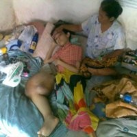 Bengkak di Kaki Johan Berubah Jadi Tumor