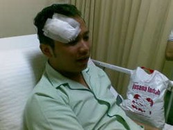 PBNU: Penganiayaan Tama Picu Gerakan Antikorupsi yang Lain