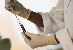 Jangan Ragu Periksa Darah Bila Punya Riwayat Keluarga Kanker