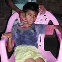 Polio Mendera, Agung Hanya Terkulai Lemah di Ranjang