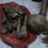 Kerangka Manusia Ditemukan dalam Karung di Lereng Bukit 