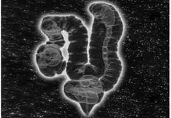 Virus di Perut Bisa Jadi Ciri Khas Seseorang