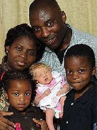 Aneh! Pasangan Kulit Hitam Lahirkan Bayi Berkulit Putih