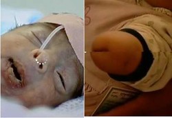 Kerusakan Genetik Anak Fallujah Lebih Parah dari Hiroshima