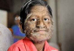 Frustasinya si Manusia Serigala Frustasinya si Manusia Serigala