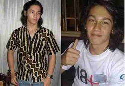 Wajah Samuel Zylgwyn Lumpuh Sebelah Karena Bells Palsy