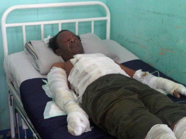 Korban Ledakan Gas Tanjung Duren