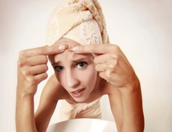 Cegah Jerawat Akibat Berolahraga