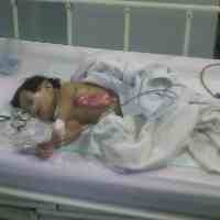 Usai Dioperasi, Tim Dokter Tunggu Perkembangan Rosita