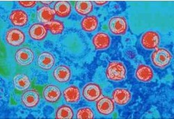 Virus Herpes Bisa untuk Obat Kanker