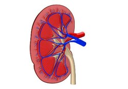 Orang Ginjal Kronik Bisa Puasa, Pasien Batu Ginjal Awal Jangan Dulu