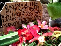 Bayi Penderita Bocor Jantung Meninggal