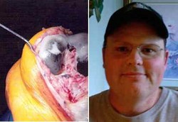 Dikira Rematik Ternyata Sendinya Menghitam