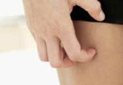 Deteksi Penyakit dari Tanda di Kulit