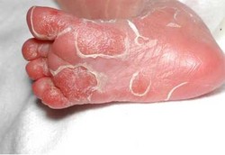 Bocah 3 Tahun Sudah Kena Raja Singa