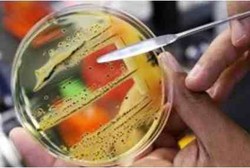 Bakteri Super yang Kebal Antibiotik Mengancam Dunia