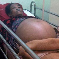 Terserang Tumor Ganas, Istri Pemulung di Bekasi Hanya Bisa Pasrah