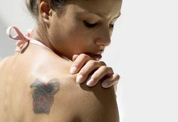 Penyebab Tato Susah Dihilangkan