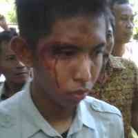 Polisi Berdalih Tak Ada Pemukulan, Korban Justru Langgar Lalin