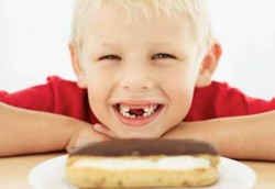 Menyiasati Makanan Manis Agar Gigi Tidak Cepat Rusak