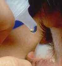 Memakai Tetes Mata Saat Puasa