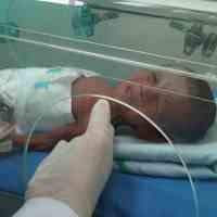 Lahir Prematur, Bayi 1 Kg Lahir di RSUD Caruban